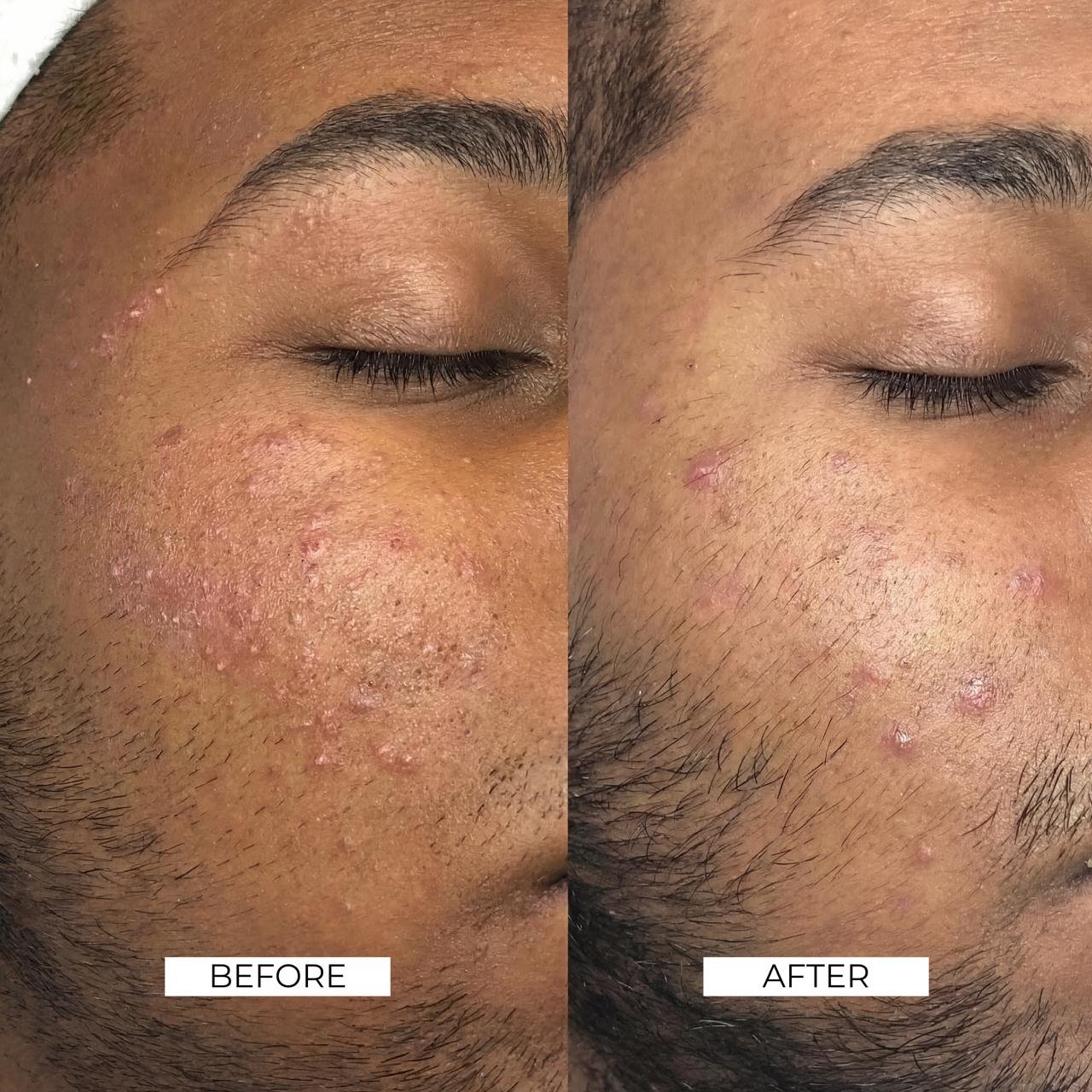 Aesthetics Before and After 8