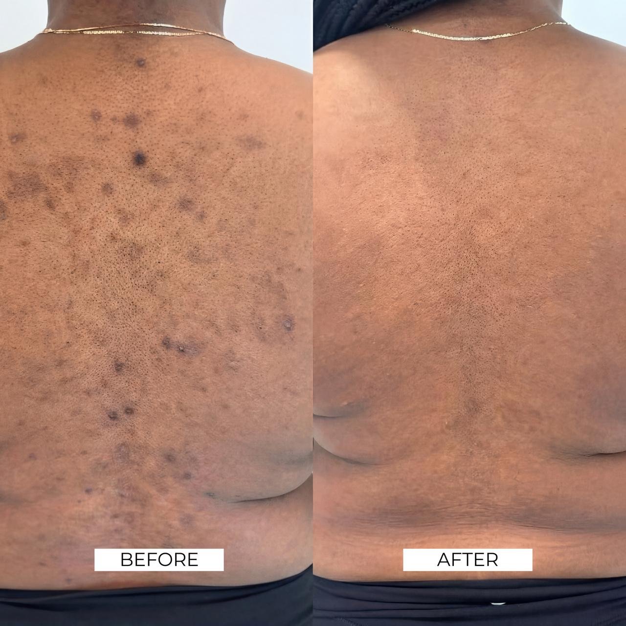 Aesthetics Before and After 7