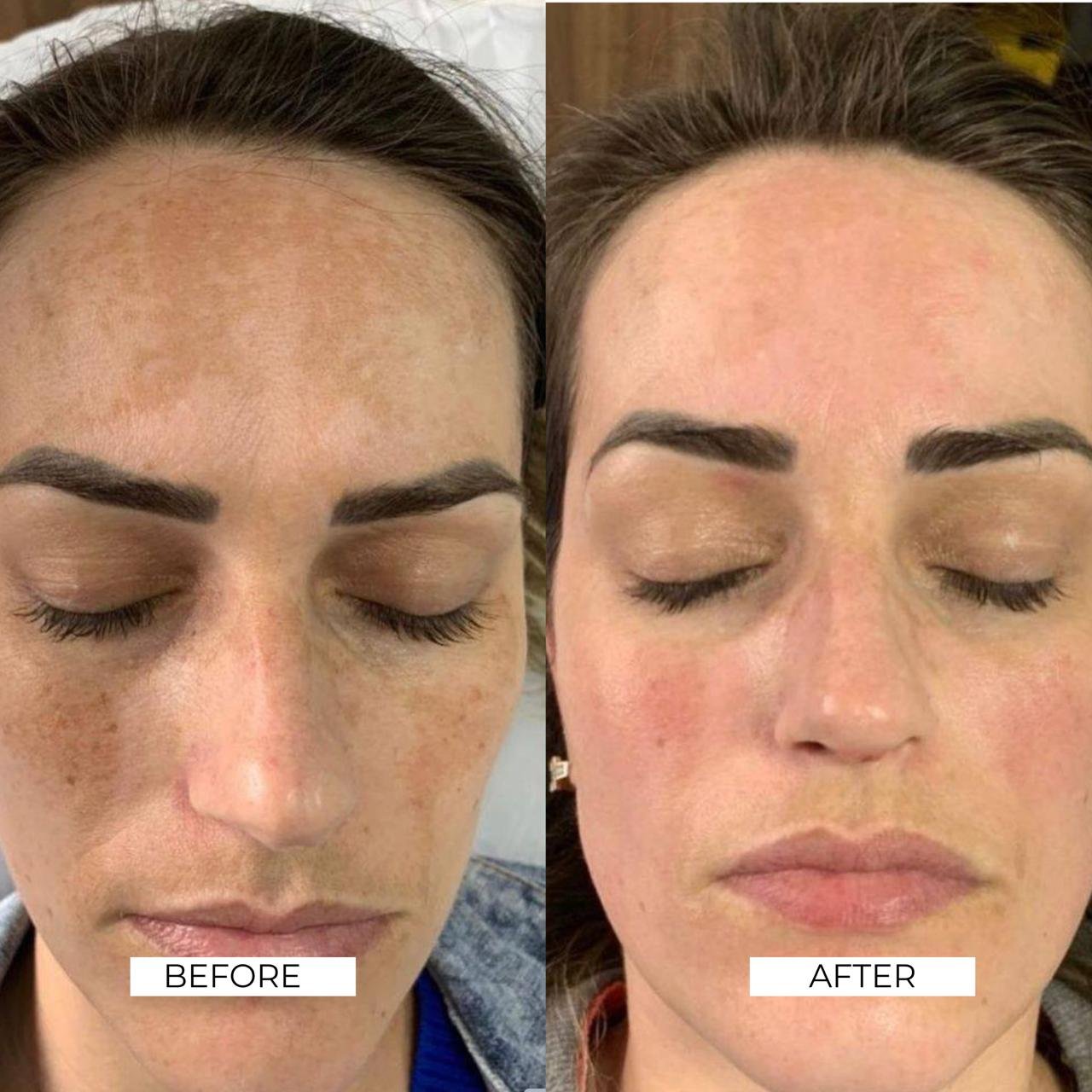 Aesthetics Before and After 9