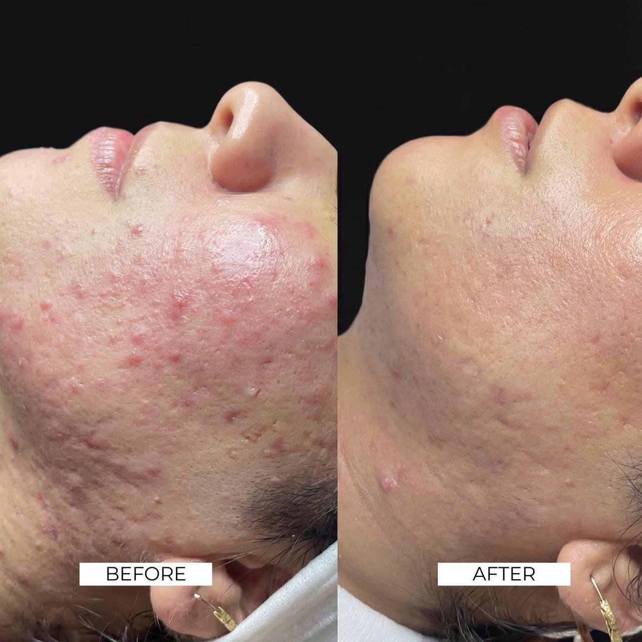 Aesthetics Before and After 5