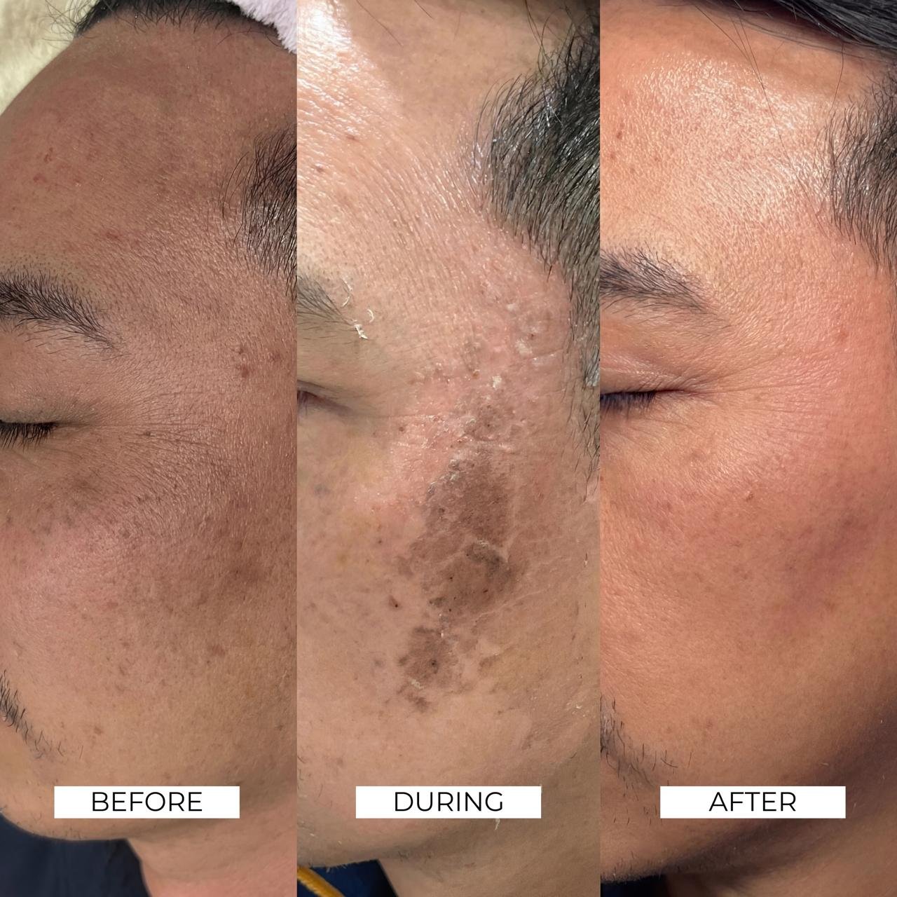 Aesthetics Before and After 4