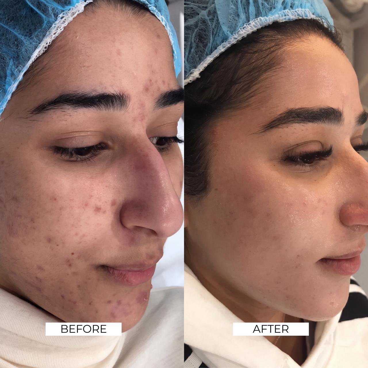 Aesthetics Before and After 6