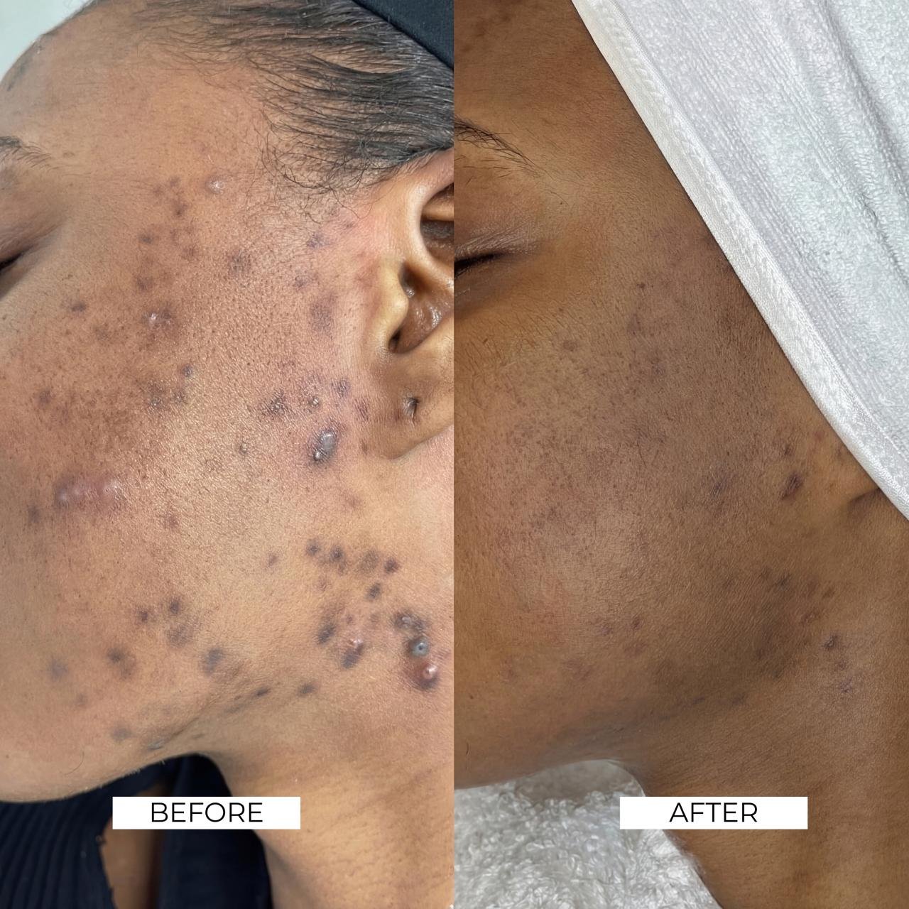 Aesthetics Before and After 2