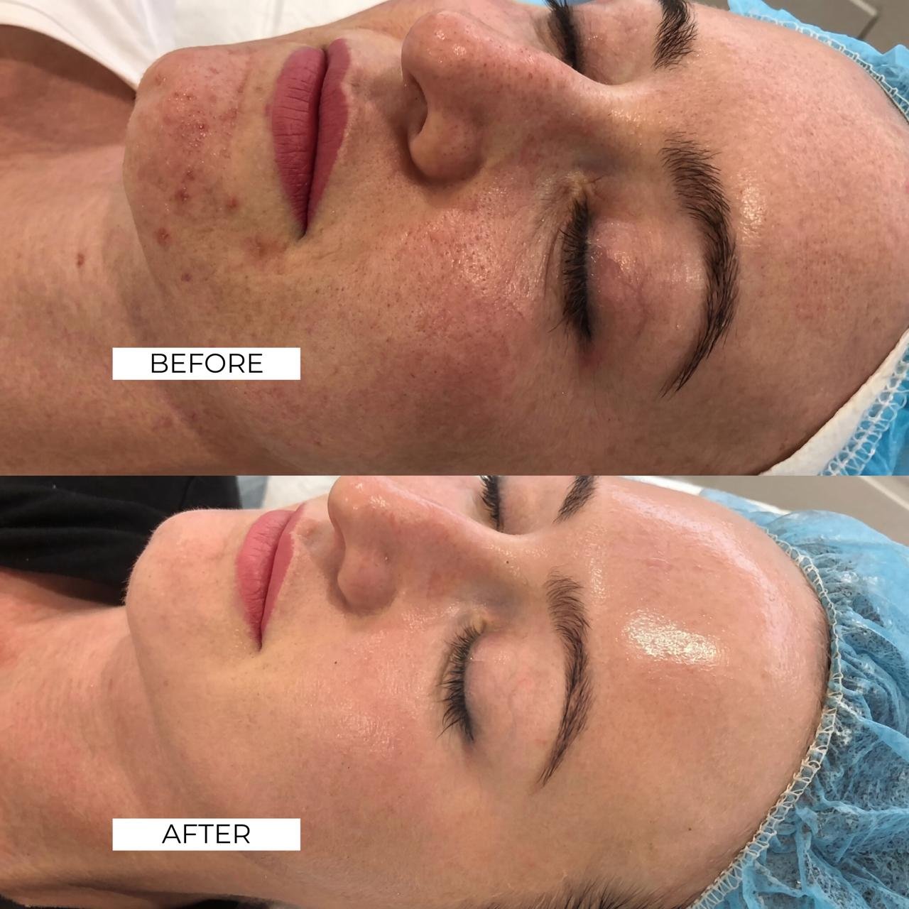 Aesthetics Before and After 1