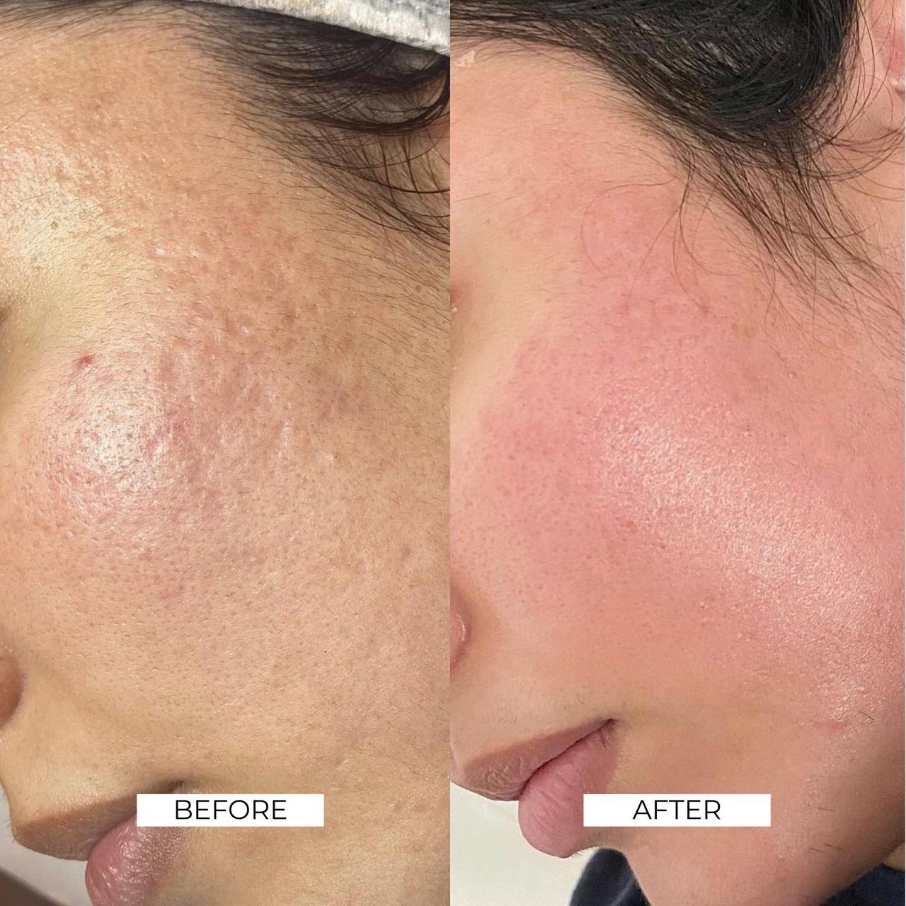 Aesthetics Before and After 3
